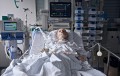 Beatmeter Patient mit Tracheostoma, Perfusoren und EKG auf einer Intensivstation